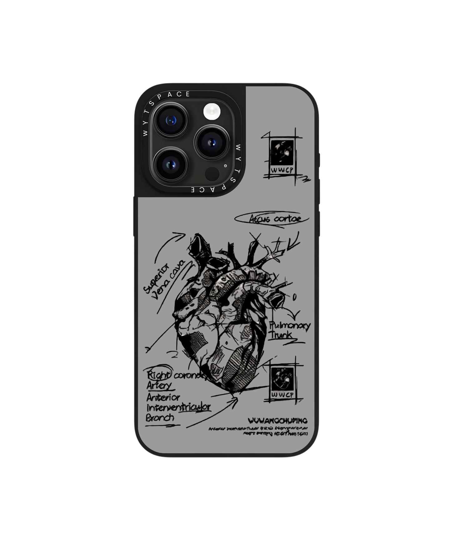 Anatomy | For Him - Elite iPhone Case Cover | Code: 571